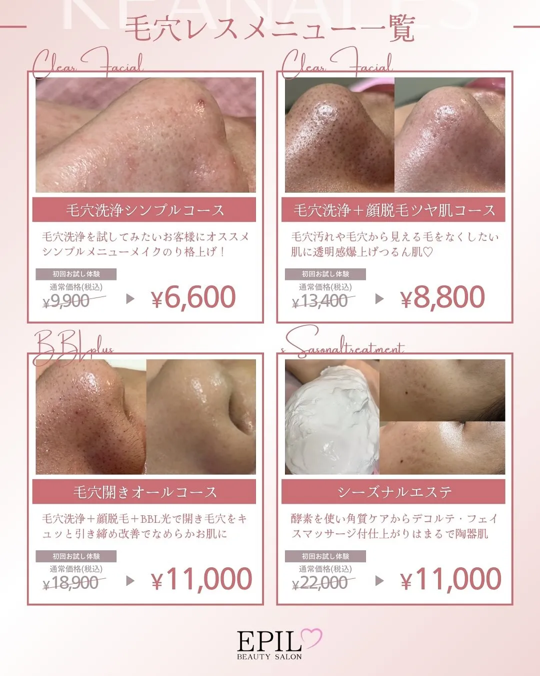 ✨EPILの毛穴洗浄✨