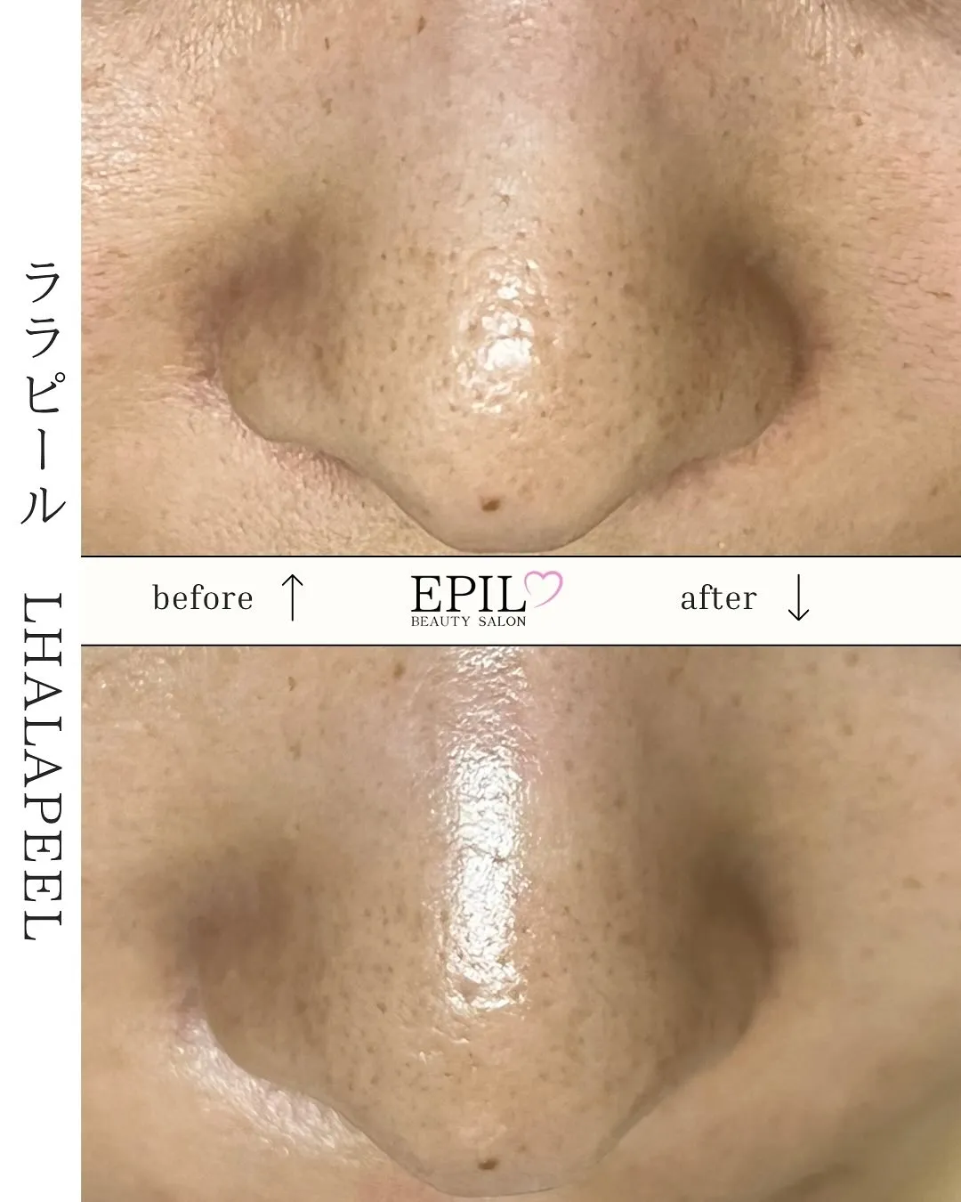 毛穴って、ただ洗っても消えないんです…