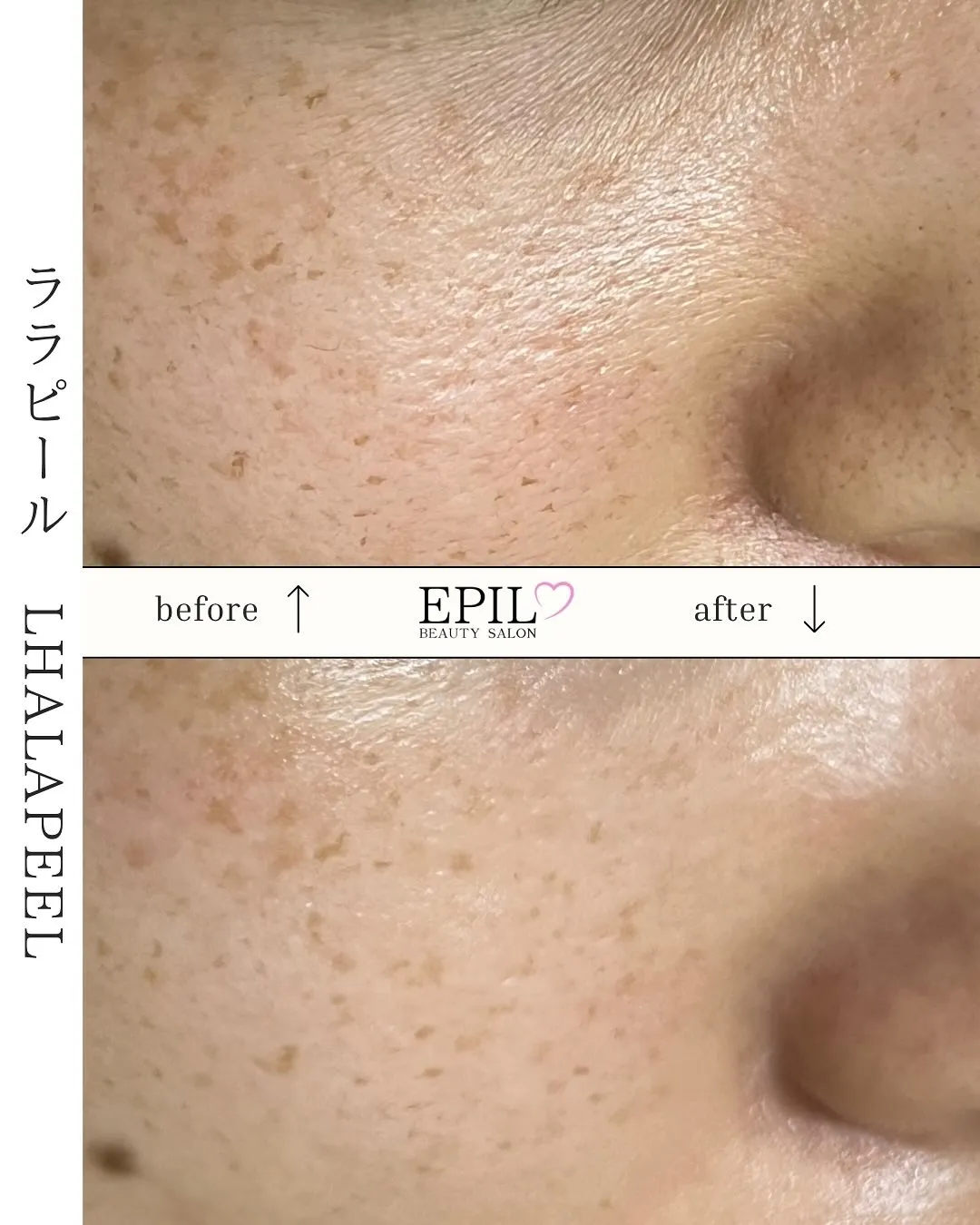 毛穴って、ただ洗っても消えないんです…