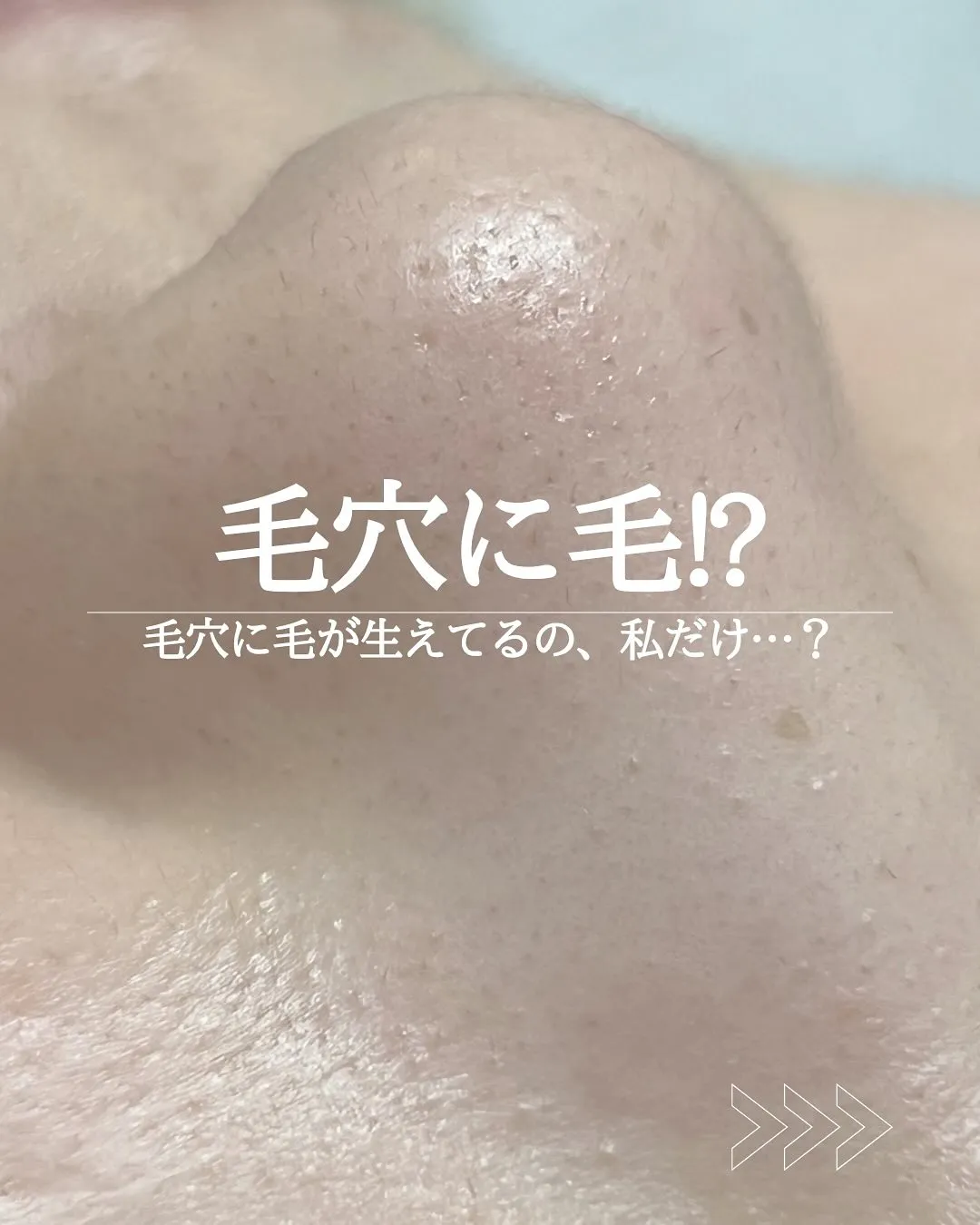 毛穴の黒ずみ、ザラつき…