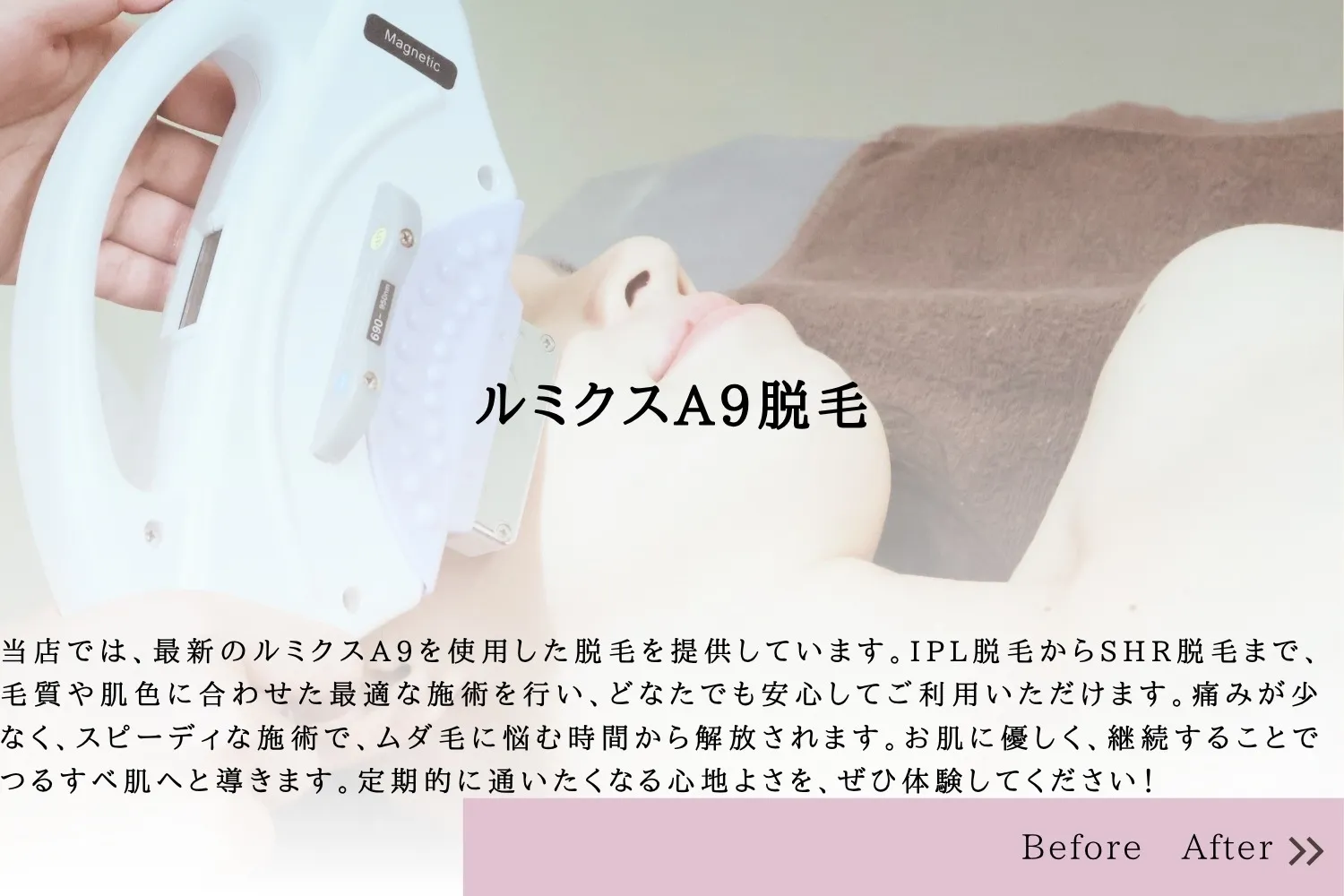 次世代脱毛機【LUMIX-A9】