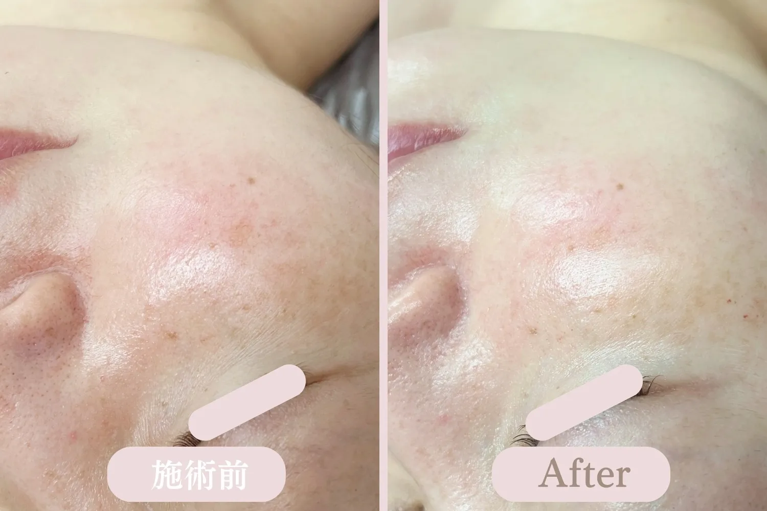 肌の土台からうるおいとツヤを　-LHALALA-