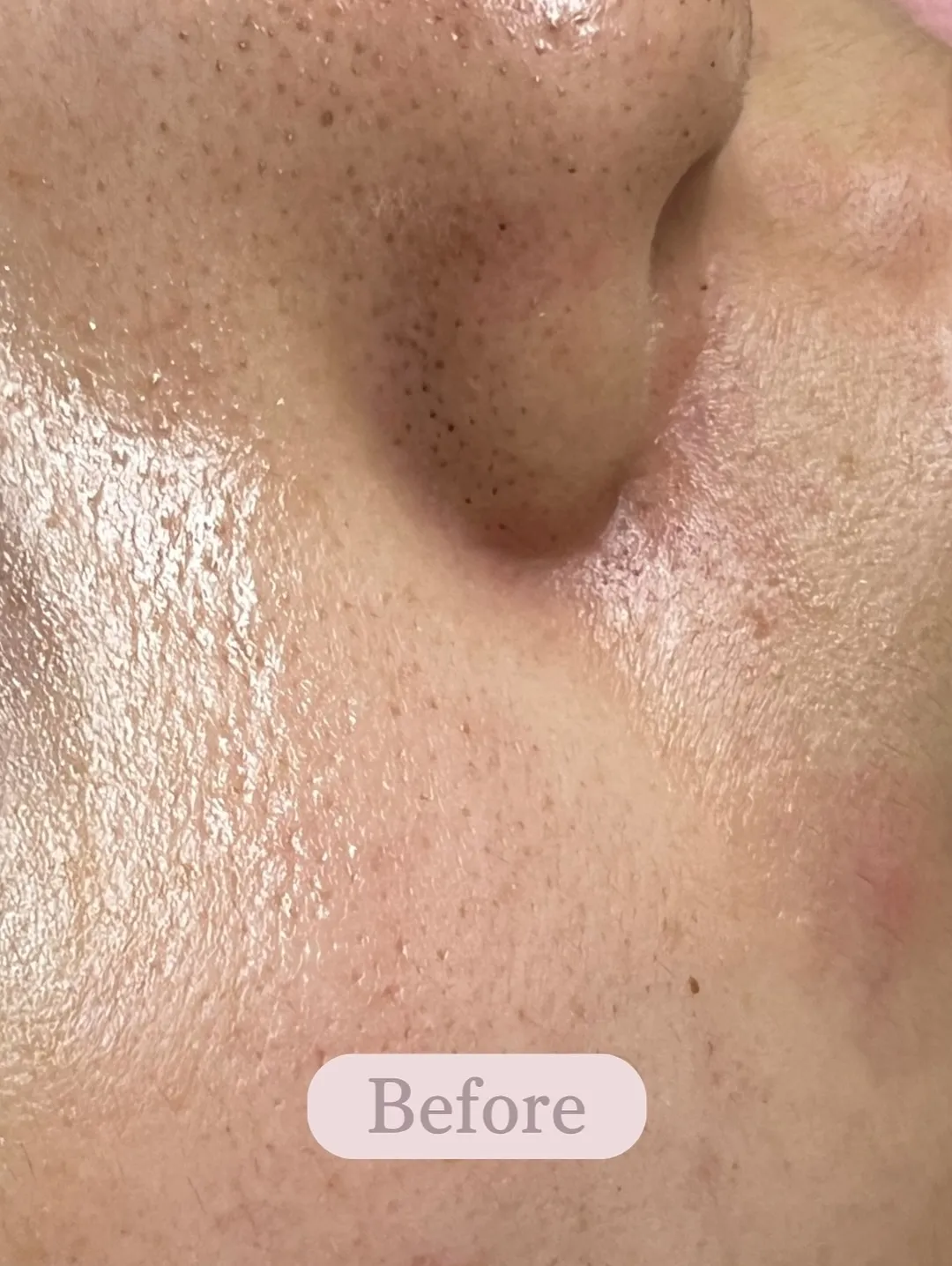 🧴【ララピール、実はリニューアルしてます🫣】