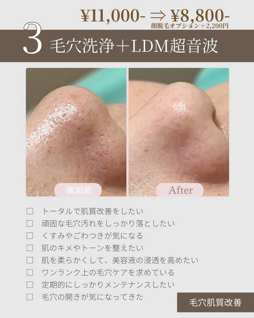 【あなたに合う毛穴ケア、選べてる?】