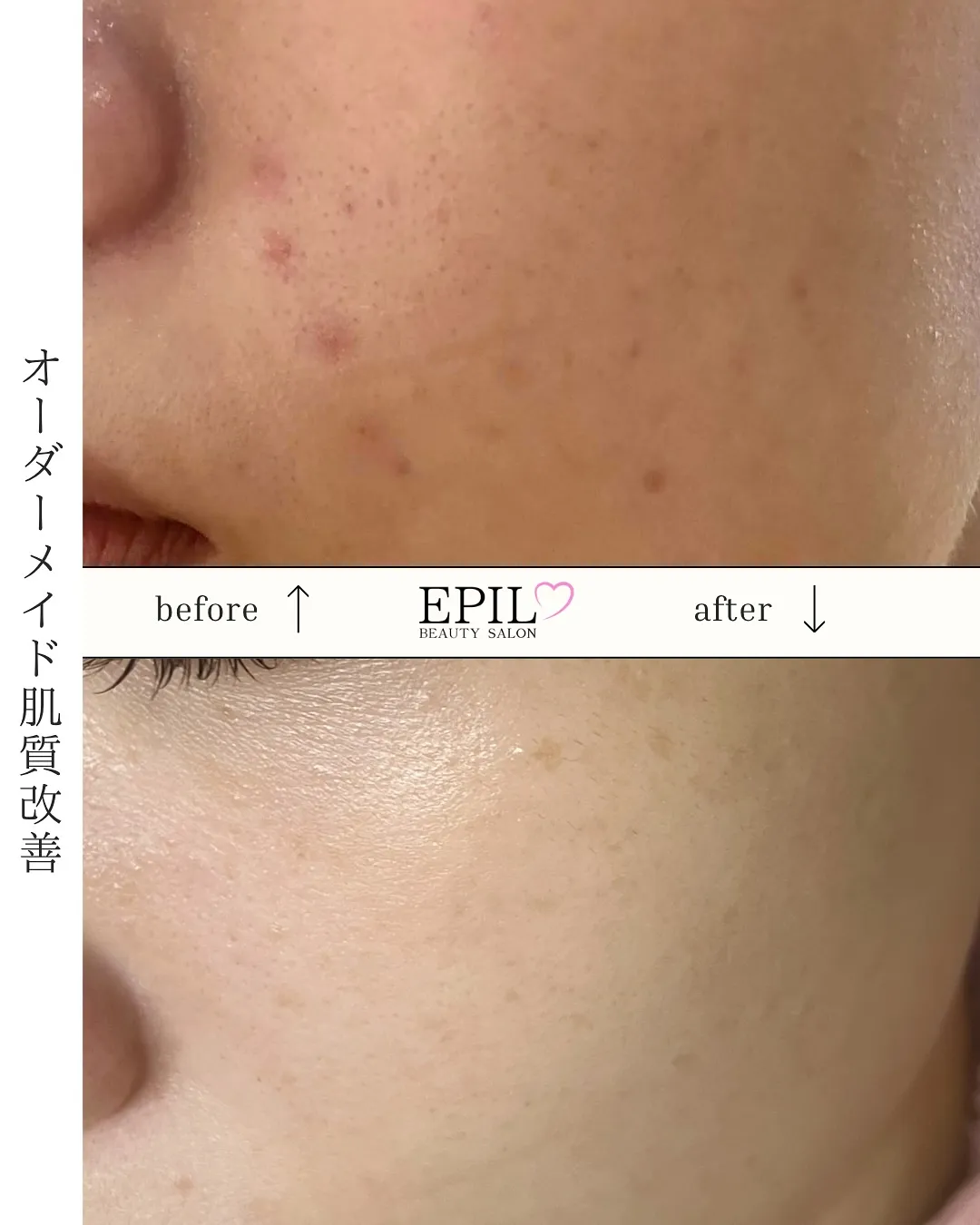 【4年前と現在の比較📷】