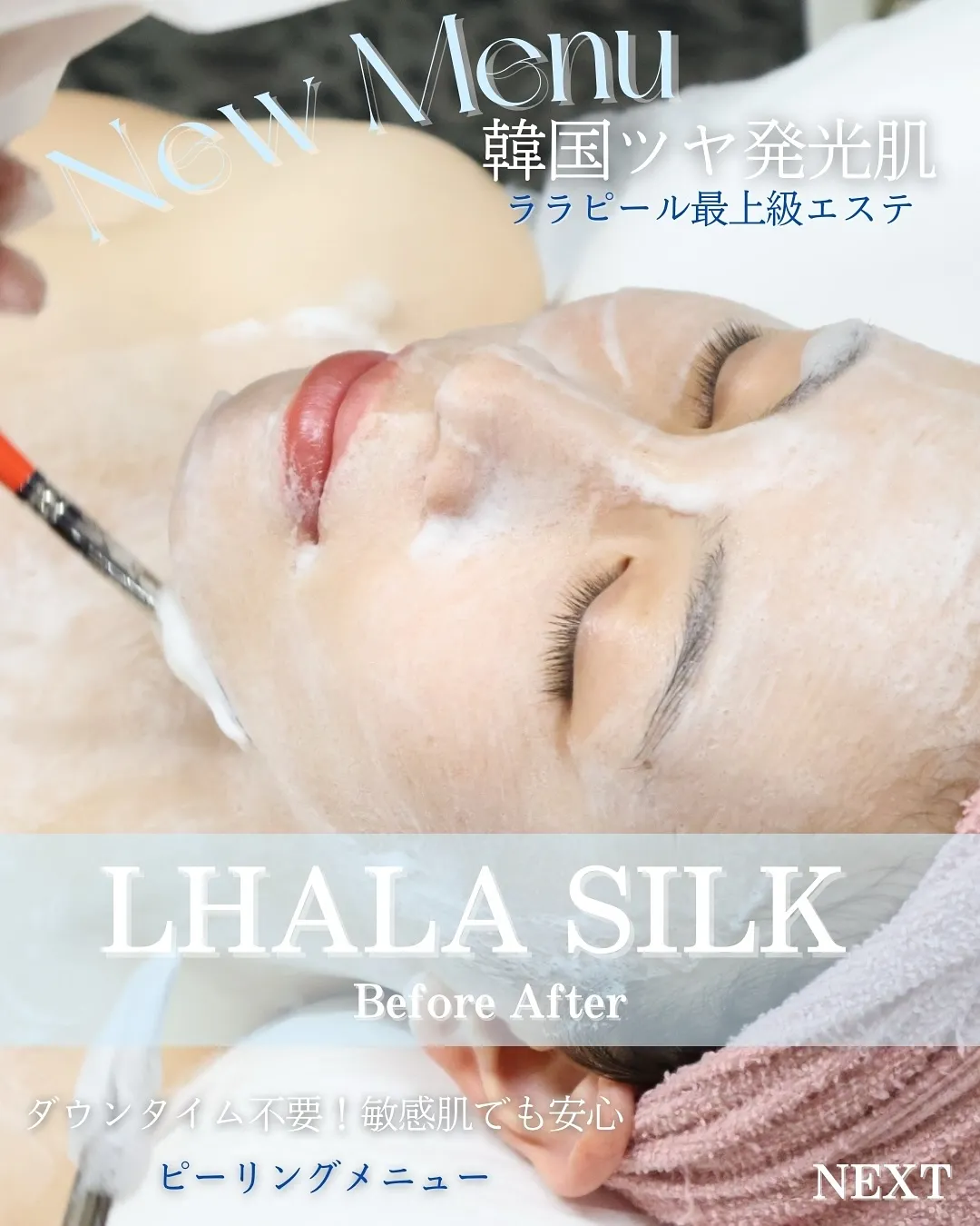 📸【Silk Skin 症例紹介】