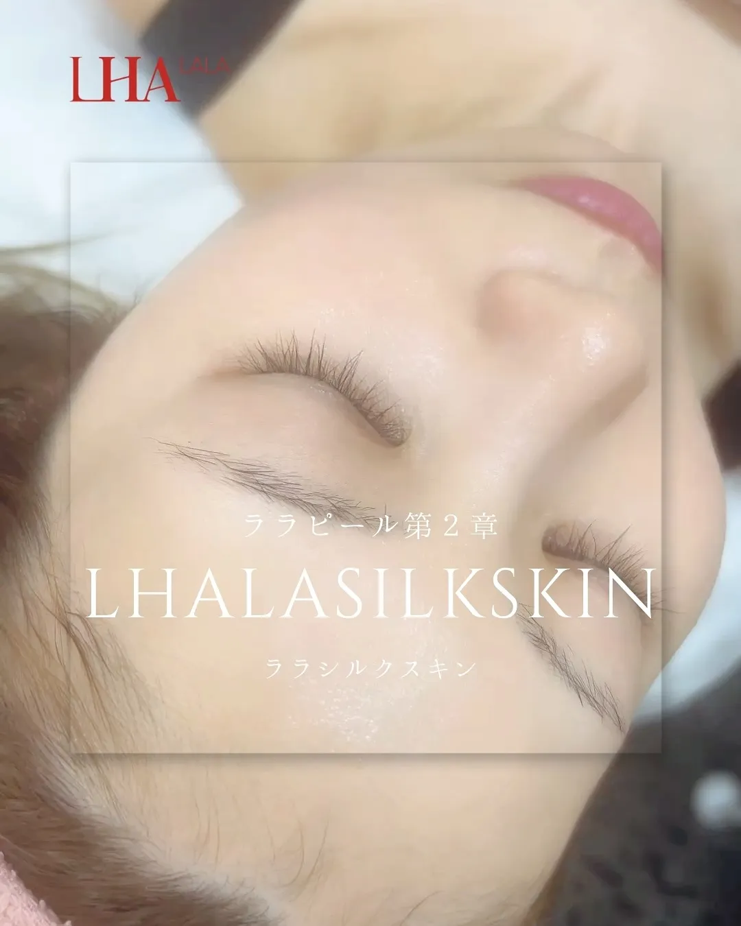 📸【Silk Skin 症例紹介】