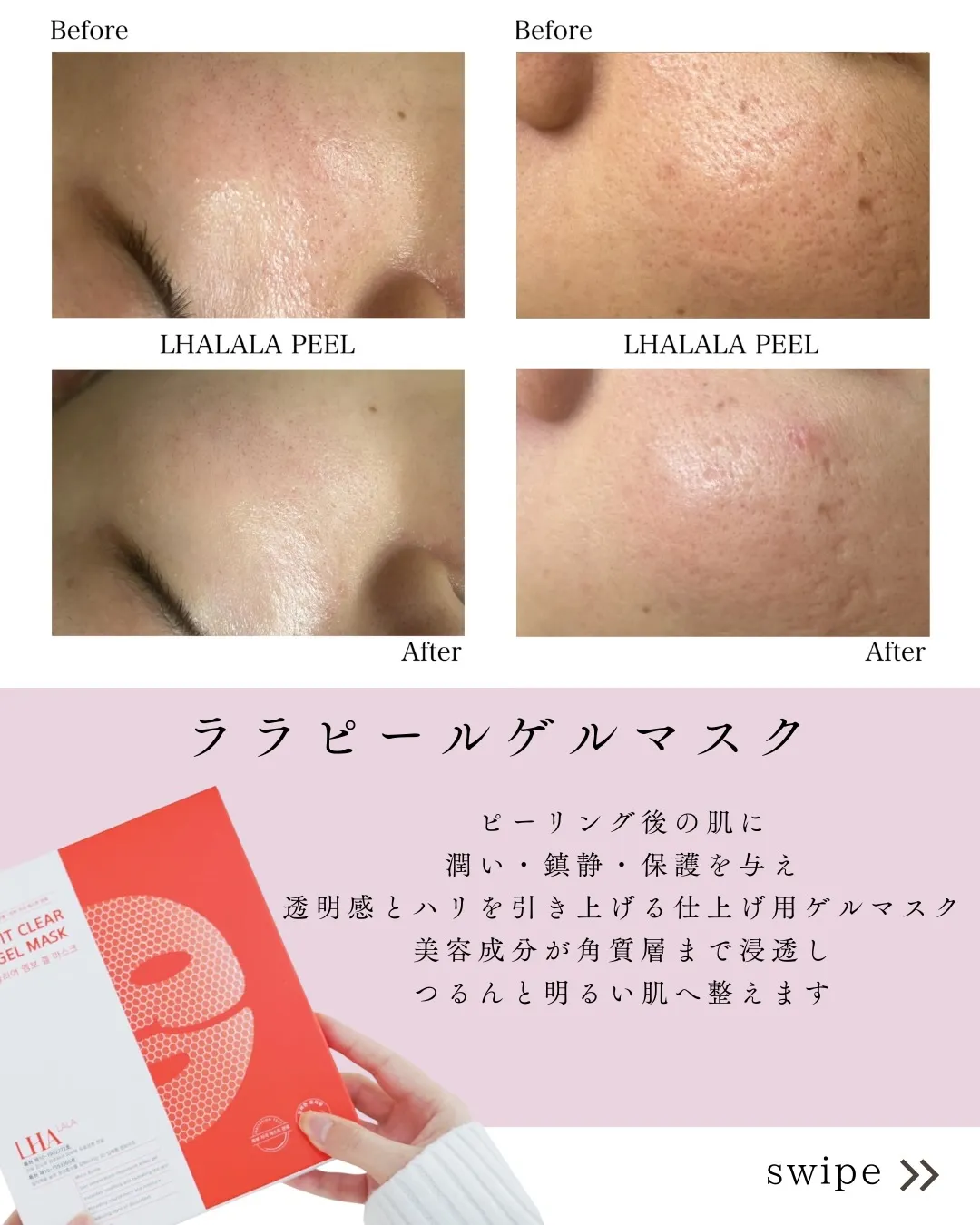 \ララピール*3回ビフォーアフター/✨/