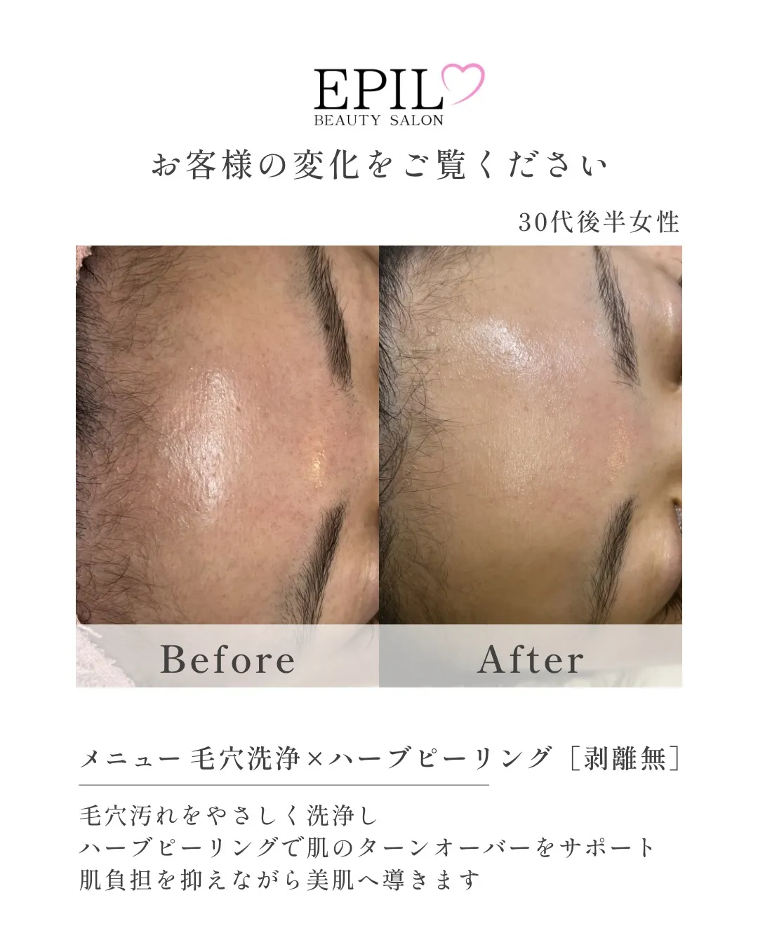 【くすみ・色ムラの原因3つ】