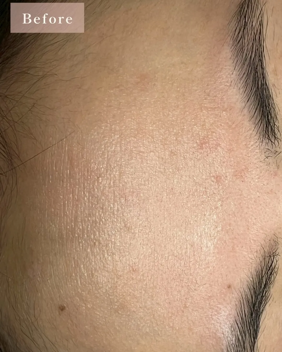 春に向けて、肌のリセットはできていますか?