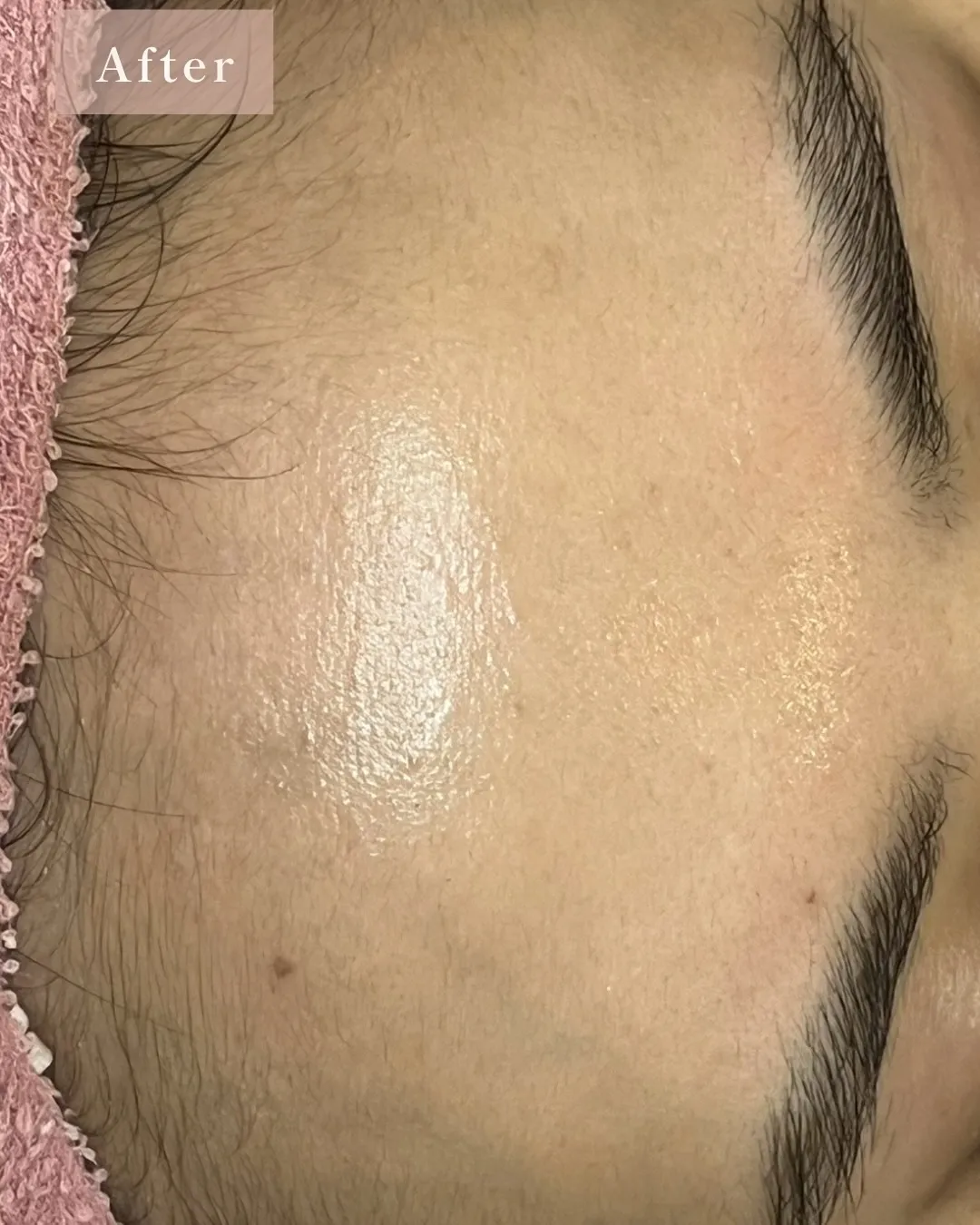 春に向けて、肌のリセットはできていますか?