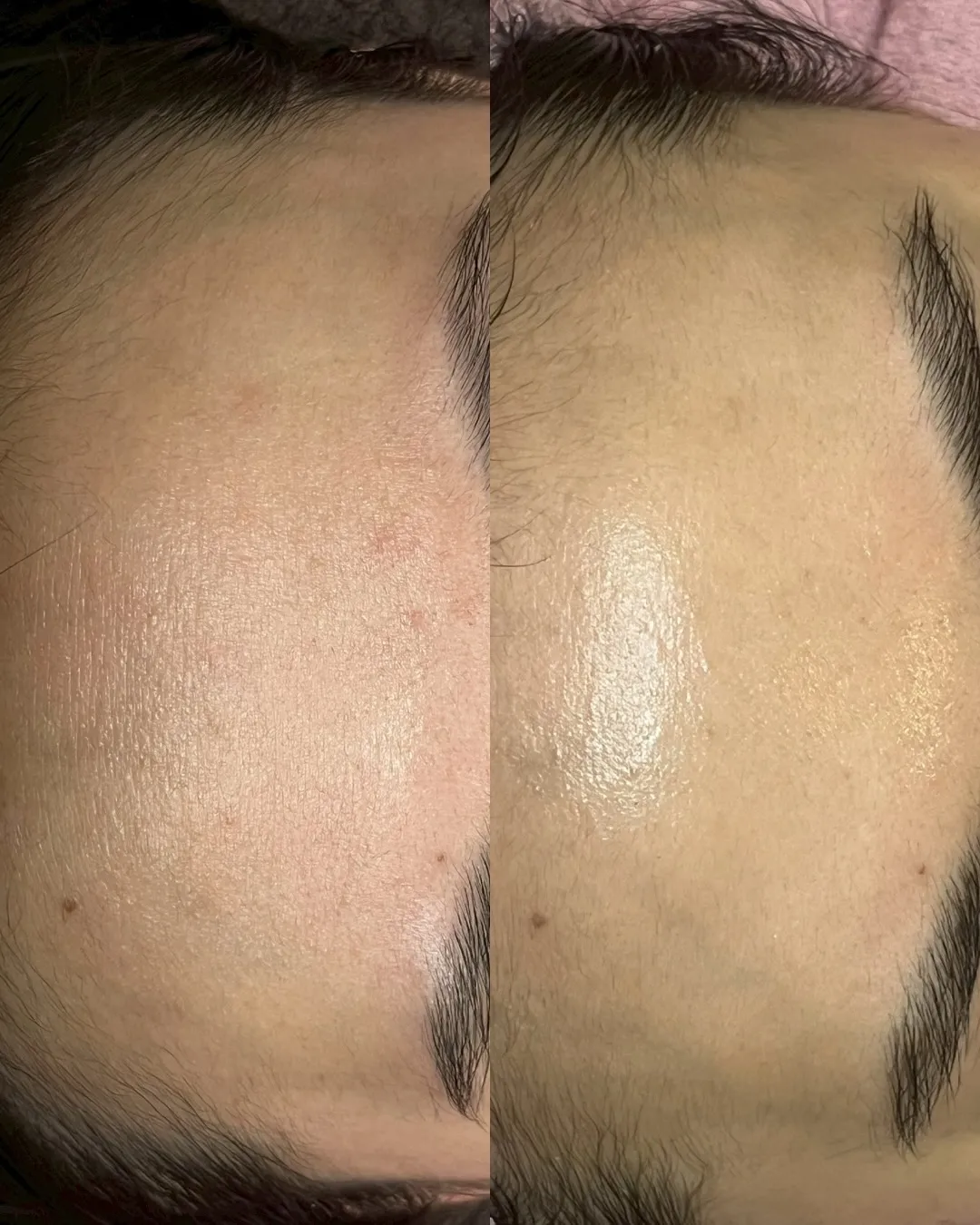 春に向けて、肌のリセットはできていますか?