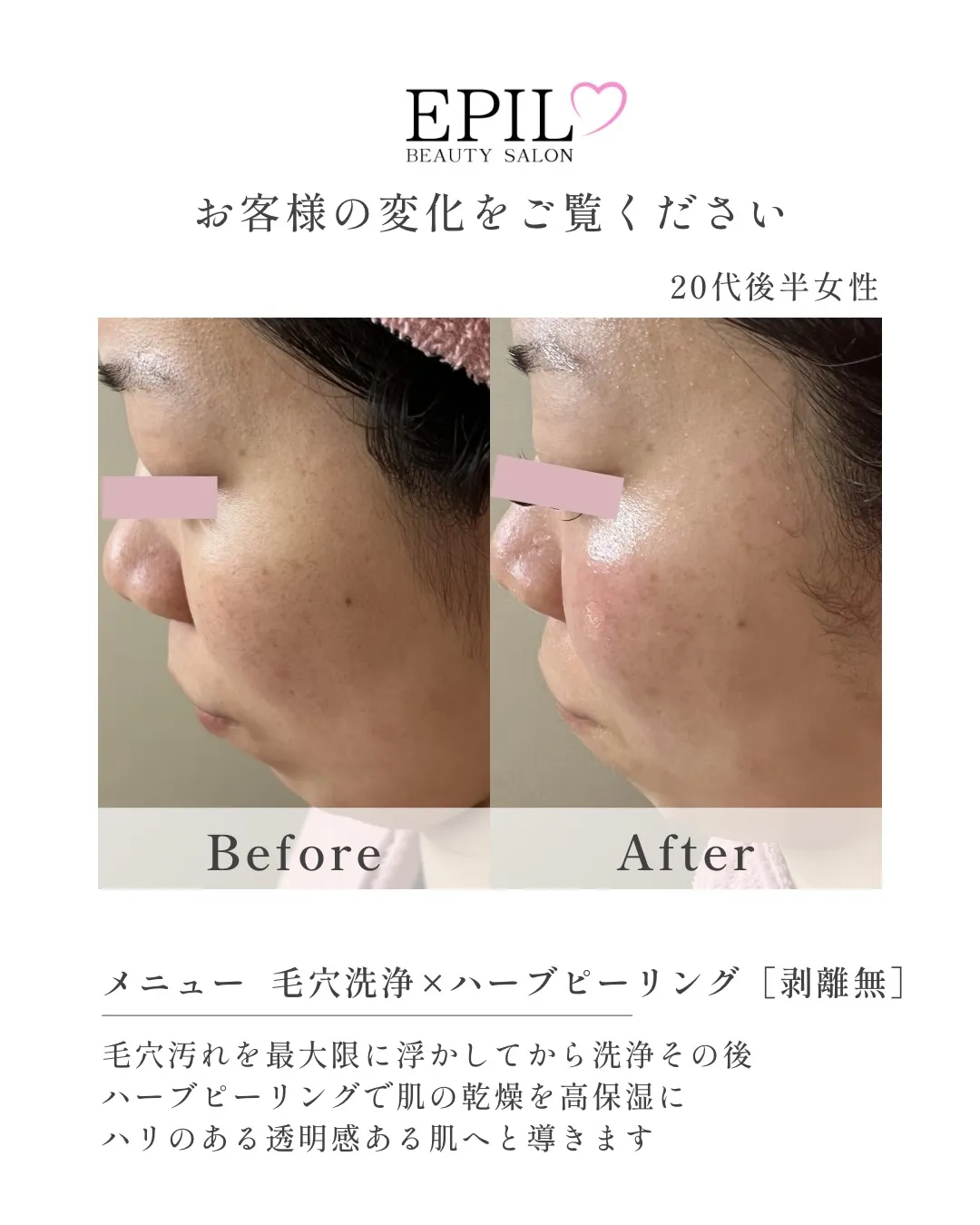 毛穴、くすみ、乾燥に悩んでる方へ💭