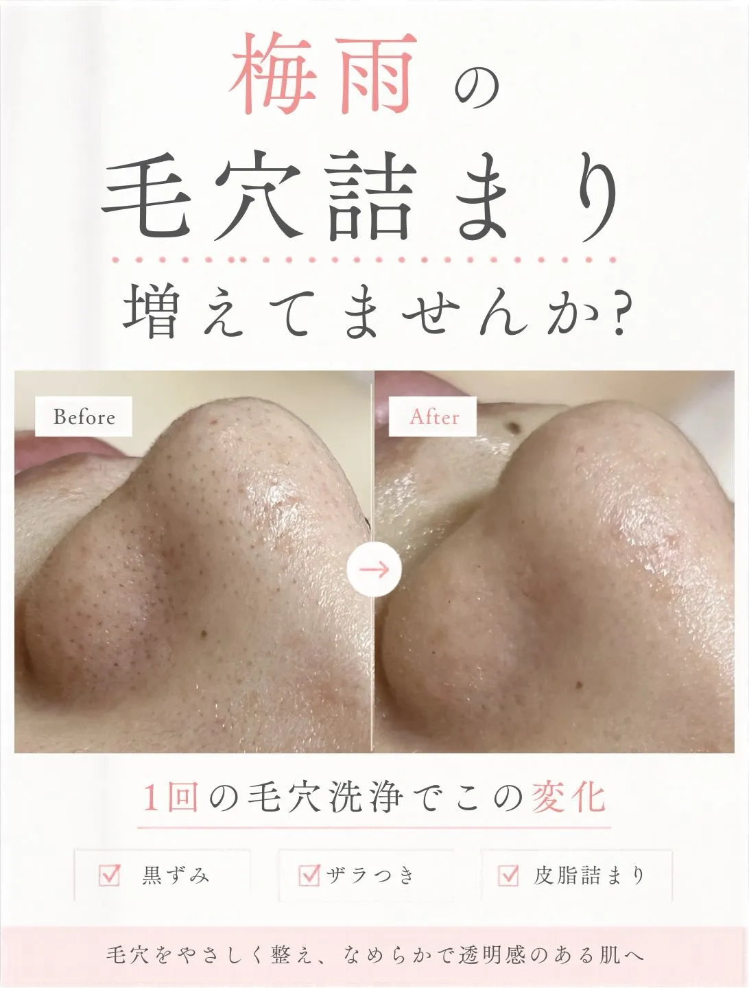 【梅雨の毛穴詰まり、増えていませんか？☔️】