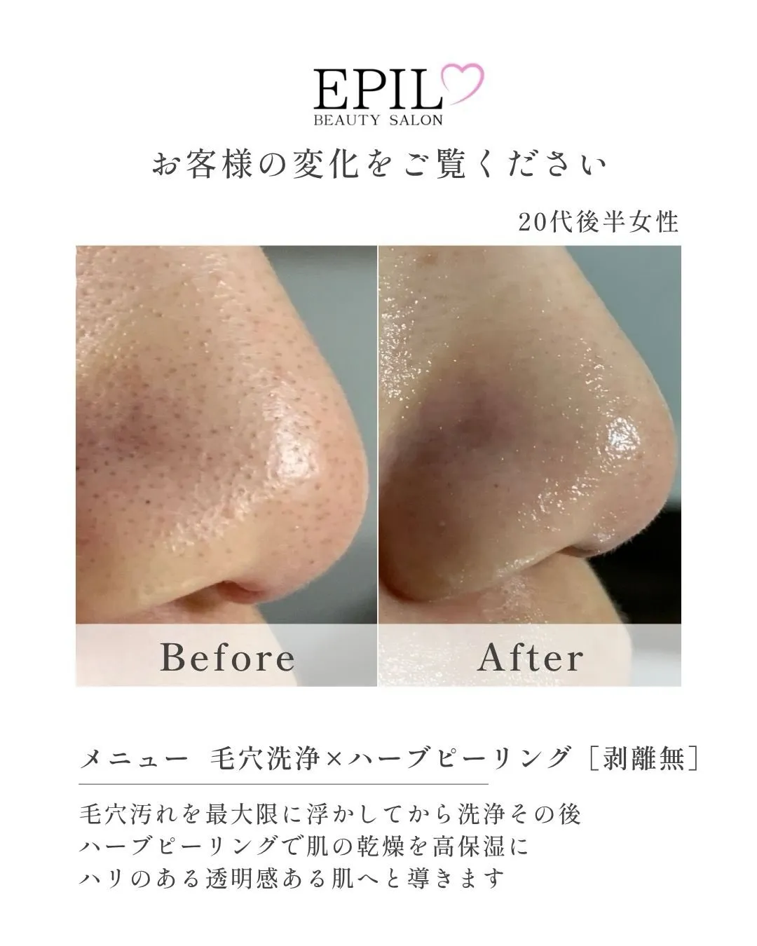 【毛穴の詰まり・黒ずみをしっかりケアしたい方におすすめ】