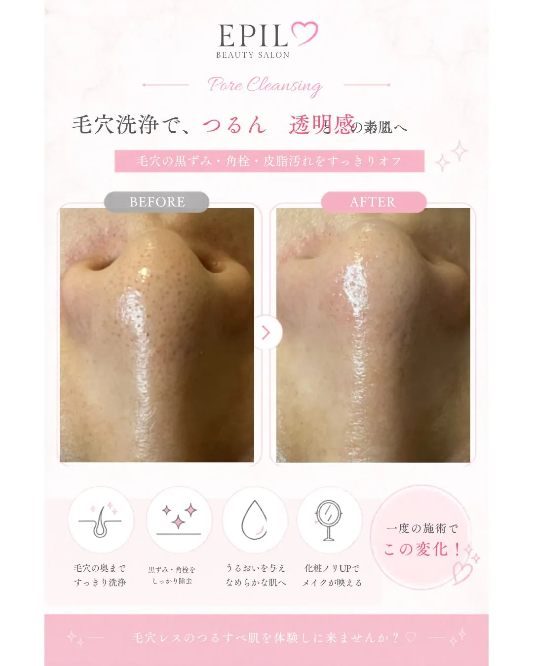 ✨毛穴洗浄ビフォーアフター✨