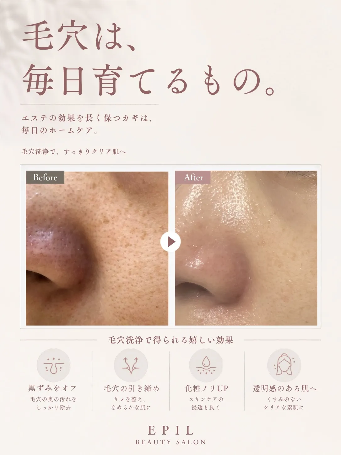 毛穴育てていますか?【スタッフ肌Before⇆After】