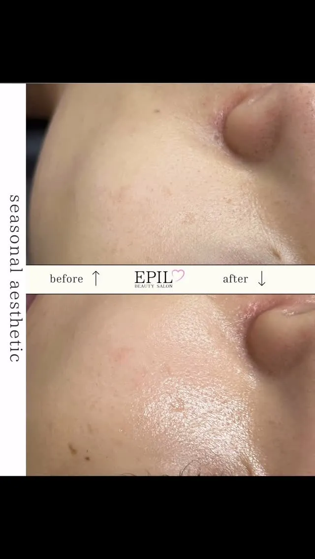 【6/19〜スタート】