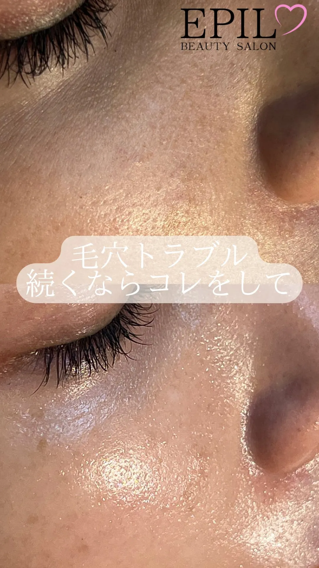 毛穴の黒ずみ、開き、ざらつき…