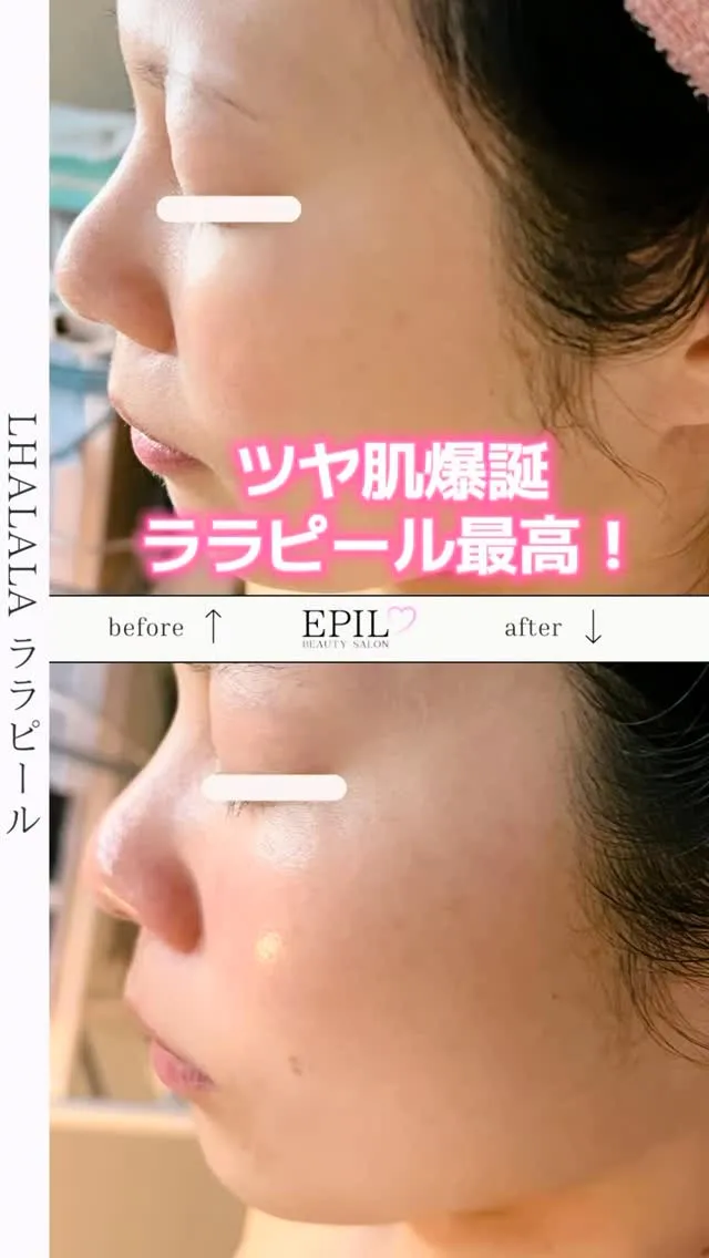 くすみ・毛穴・ごわつきが気になる方にこそ