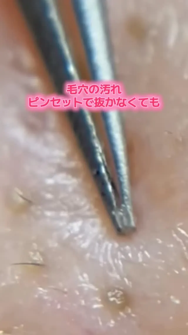 毛穴って、自分でケアしてもなかなか変わらなくて悩んでいません...