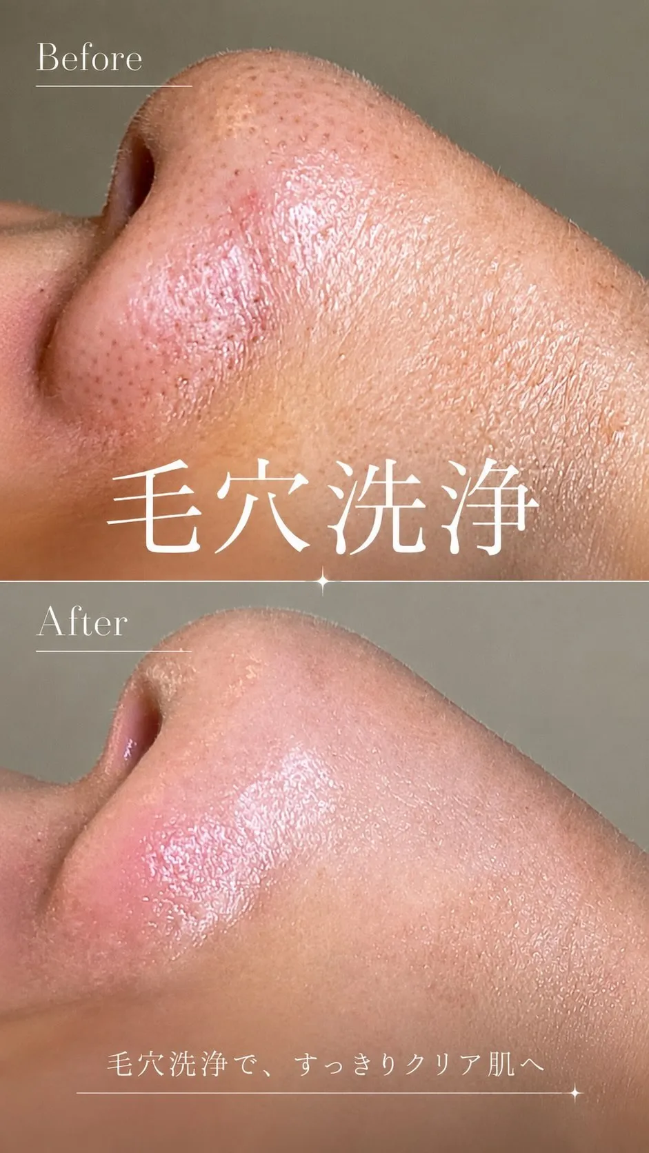 肌に気を使う男、増えてます。